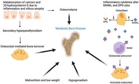 Celiac Disease And Bone Archives Of Endocrinology And Metabolism