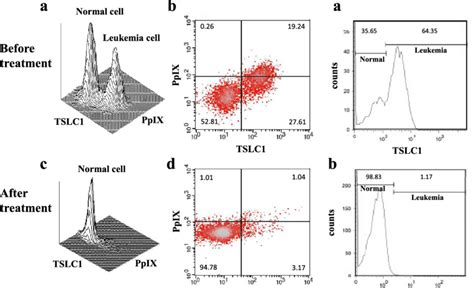 Fcm Analyses Of Chronic Atl Patient Specimens Before And After Ala Pdt