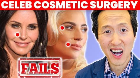 Doctor Reacts To Celebrity Plastic Surgery Fails Dr Anthony Youn