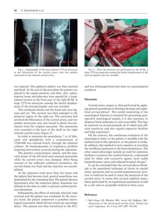 Resection Of A Large Carotid PDF