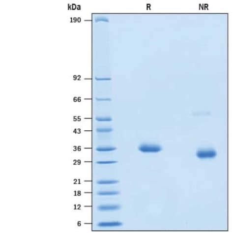 R Recombinant SARS CoV 2 K417E Spike RBD His tag Protein CF 100 μg