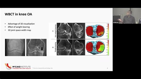 Imaging Characteristics Of A Weigh Bearing Cone Beam CT System Msc