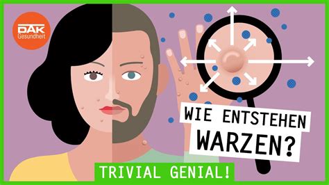 Wie Entstehen Warzen Trivialgenial Dak Gesundheit Youtube