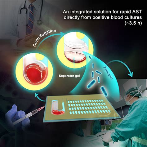 A powerful tool to accelerate antimicrobial susceptibility testing for bloodstream infections ...