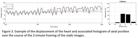 Data Driven Motion Correction For Cardiac Pet Journal Of Nuclear Medicine