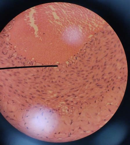 Epithelial Tissue Flashcards Quizlet