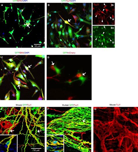 Characteristics Of Lentivirus Transduced Mouse And Human Gut Derived