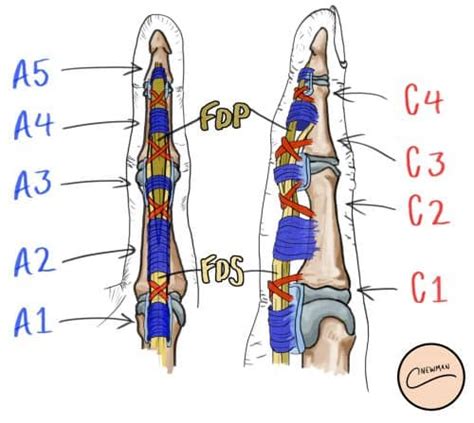 Flexor Tendon Repair Surgical Repair Teachmesurgery