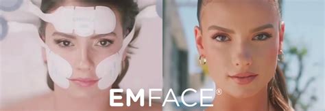 Emface Less Wrinkles More Lift Dr Rita Rakus London