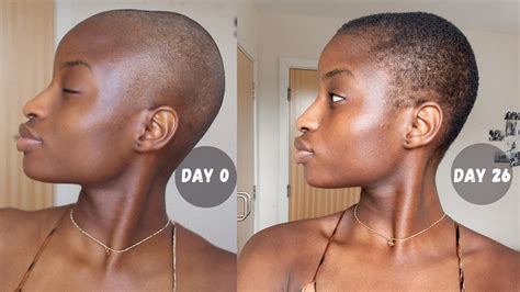 1 Month Update Post Shaving My Hair My Scalp Care Routine Hair