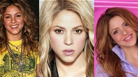 Los Retoques Est Ticos Que Se Habr A Hecho Shakira De La Mentoplastia