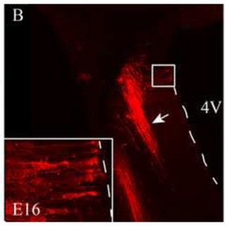 Dii Labeled St Fibers A C Dii Placed Into The Geniculate Ganglia