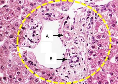 MemorAid Test 1C1 Tentamens Histologie 64 Portaal Veld 2