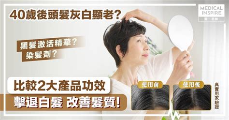 40歲後想改善白髮不顯老？黑髮激活精華、染髮劑邊款更好？揀錯隨時更傷頭髮！ Medical Inspire 醫．思維 Line Today