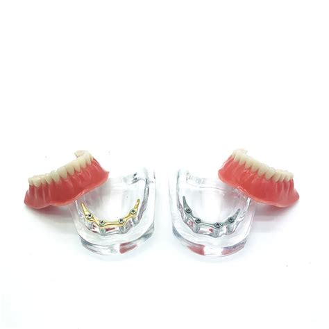 Dental Repair Teeth Implant Model Denture Teeth Mandibular Model