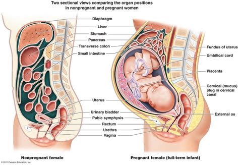 Simulation Cases Cliff S Notes Appendicitis In Pregnancy — Downeast Emergency Medicine