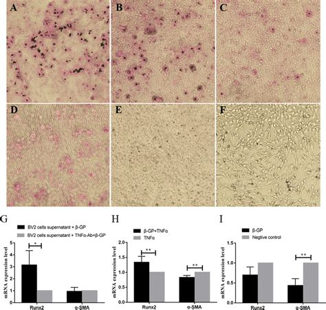 The Influence Of Tnf Expressed By Bv Cells For Vsmc Calcification