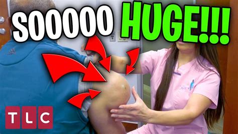 The GROSSEST And MOST DISGUSTING Moments Moments On Dr Pimple Popper