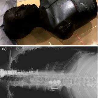 The Experimental Setup A And A Radiograph B Of The Custom