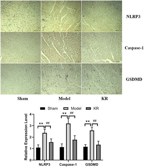 KR Decreases NLRP3 Caspase1 And GSDMD Levels Via Immunohistochemical