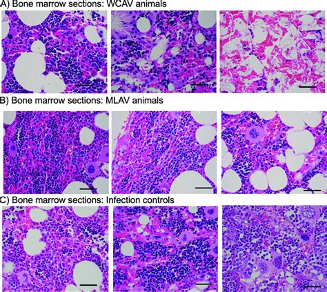 Post Infection Challenge Histopathology Sections Of Bone Marrow At 40x