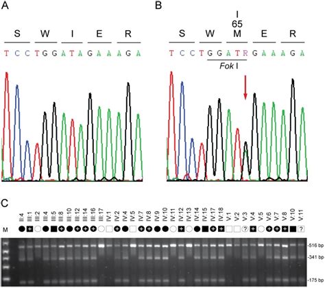 A Sanger Sequence Trace Of The Wild Type Allele Showing Translation