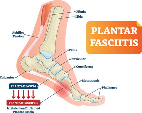 Ocean County Foot And Ankle Surgical Associates Pc Addresses Plantar