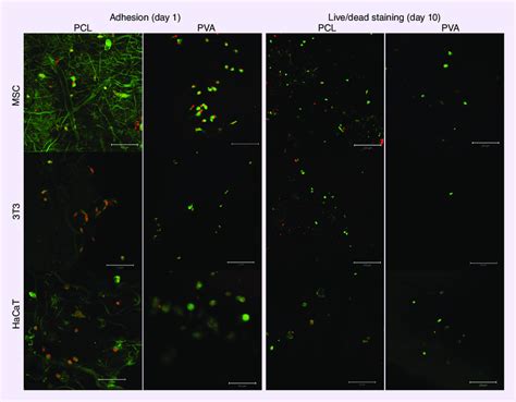 Cell Adhesion And Viability On Scaffolds Adhesion Of Msc T