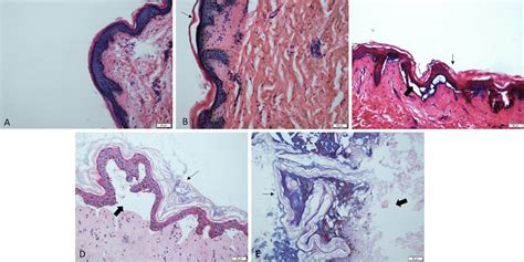 Microphotograph Showing The Epidermis A The Epidermal Layer Shows No