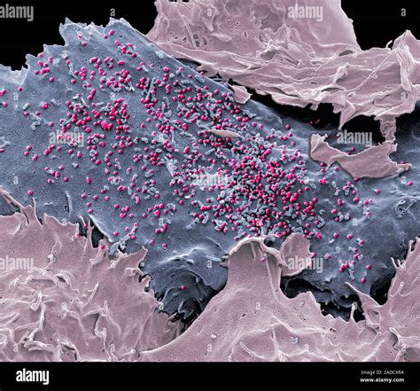 Hiv Infected T Cell Coloured Scanning Electron Micrograph Sem Of