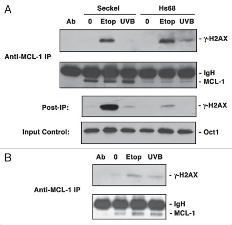 Association of MCL 1 and γ H2AX is altered in AtR defective cells A