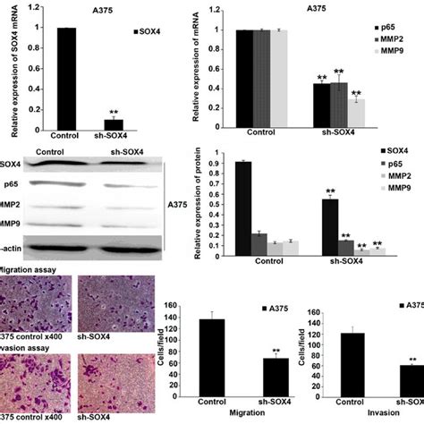 Overexpression Of Sox Promotes Melanoma Cell Migration And Invasion