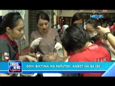 Doh Records More Fireworks Related Injuries