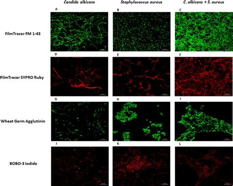 Analysis By Confocal Microscopy Of The S Aureus And C Albicans Download Scientific Diagram