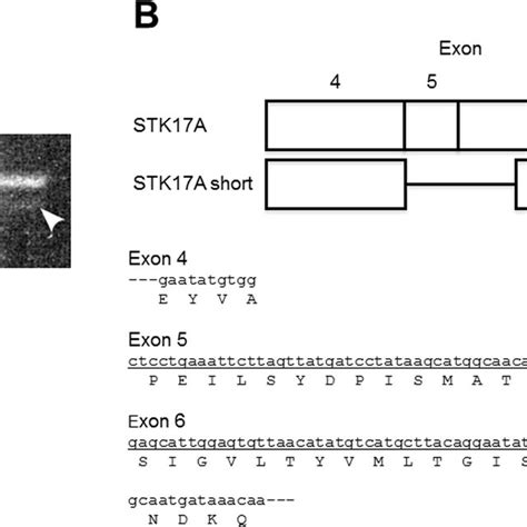 A Short Isoform Of Stk17a In Hepg2 Cells A Polymerase Chain Reaction