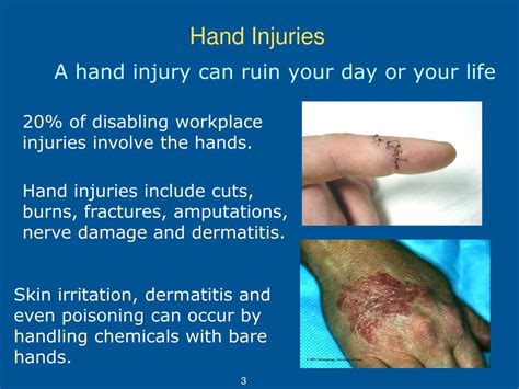 PPT - Hand Protection (Gloves) PowerPoint Presentation, free download ...