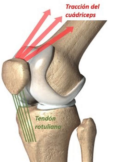 Condromalacia Rotuliana Dr Gallego Traumatología Deportiva y