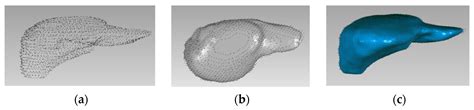 Livers Free Full Text Assisting Difficult Liver Operations Using 3d