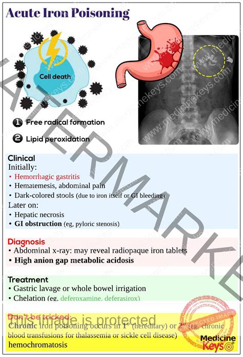 Acute iron poisoning - Medicine Keys for MRCPs