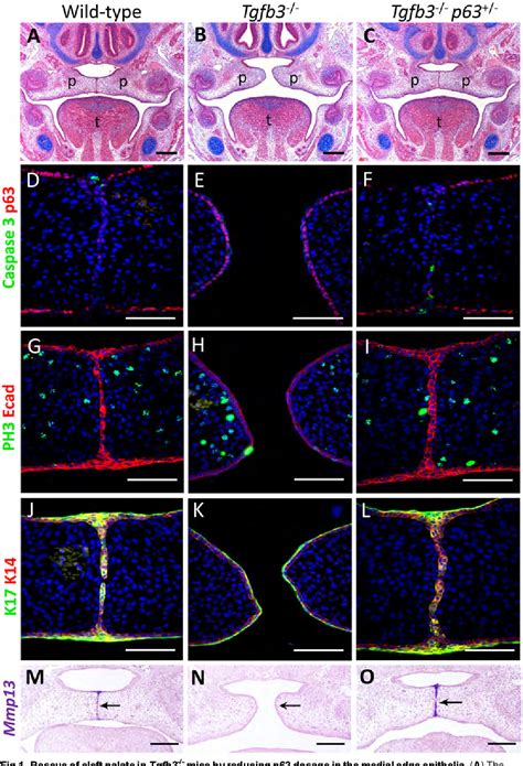 Figure From P Exerts Spatio Temporal Control Of Palatal Epithelial