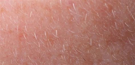 How To Safely Remove Fiberglass From Skin