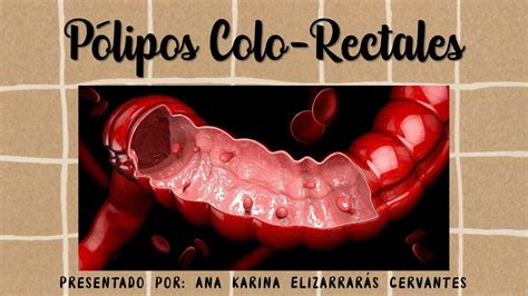 P Lipos Colo Rectales Ana Karina Elizarrar S Cervantes Udocz