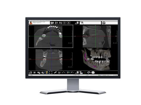 Console De Diagnostic Radiologie Ikonex Medical