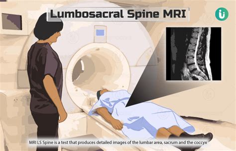 Lumbosacral Ls Spine Mri Procedure Purpose Results Cost Price