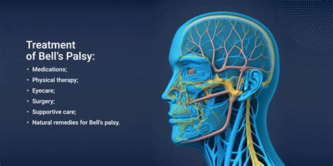 Bells Palsy Diagnosis And Treatment Essentials