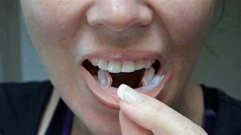 Whitening strips: Do they work and how to use them