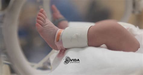 Uti Neonatal As Primeiras Etapas Na Admiss O Do Prematuro