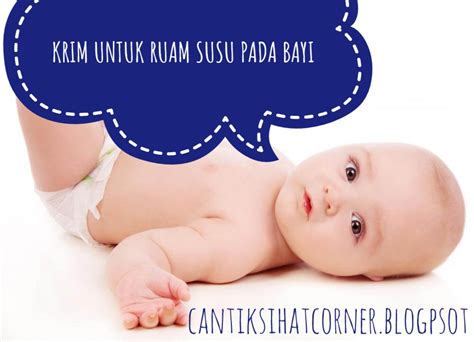 Krim Berkesan Dan Cepat Hilangkan Ruam Susu Pada Bayi Cantik Sihat Corner