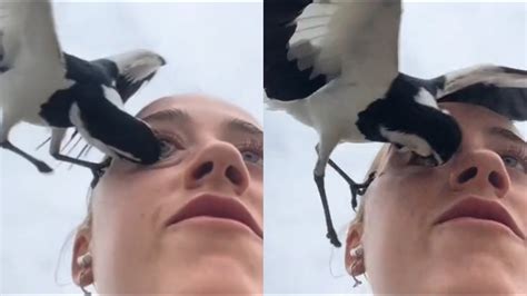 Bird Pecks Woman S Eye YouTube