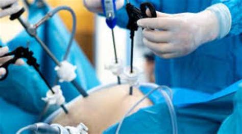 Bariatric Surgery In Turkey Types Cost Hospitals